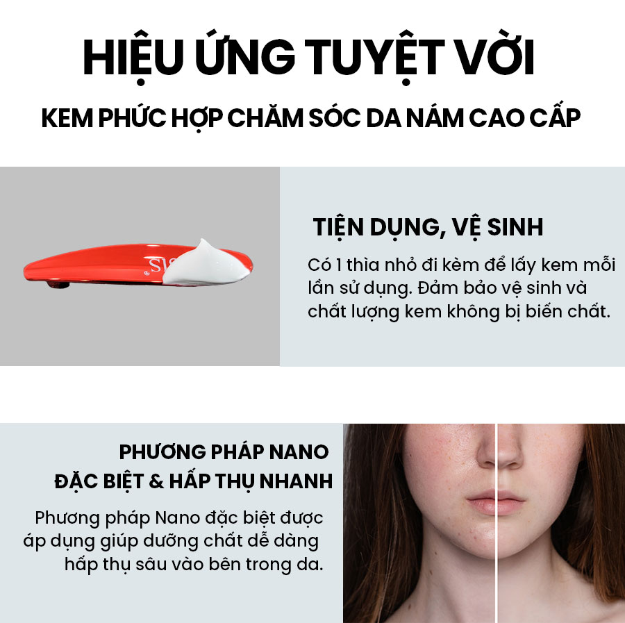 Kem Dưỡng Ẩm Trắng Da WHISIS Premium MELASMA Care Complex Cream Mờ Nám, Tàn Nhang 50g