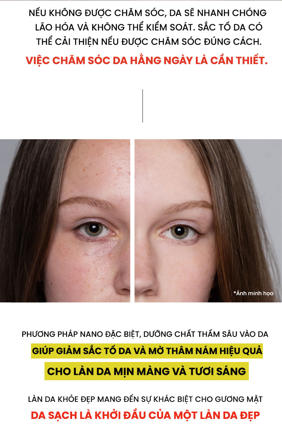 Kem Dưỡng Ẩm Trắng Da WHISIS Premium MELASMA Care Complex Cream Mờ Nám, Tàn Nhang 50g