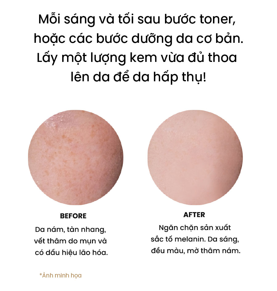 Kem Dưỡng Ẩm Trắng Da WHISIS Premium MELASMA Care Complex Cream Mờ Nám, Tàn Nhang 50g